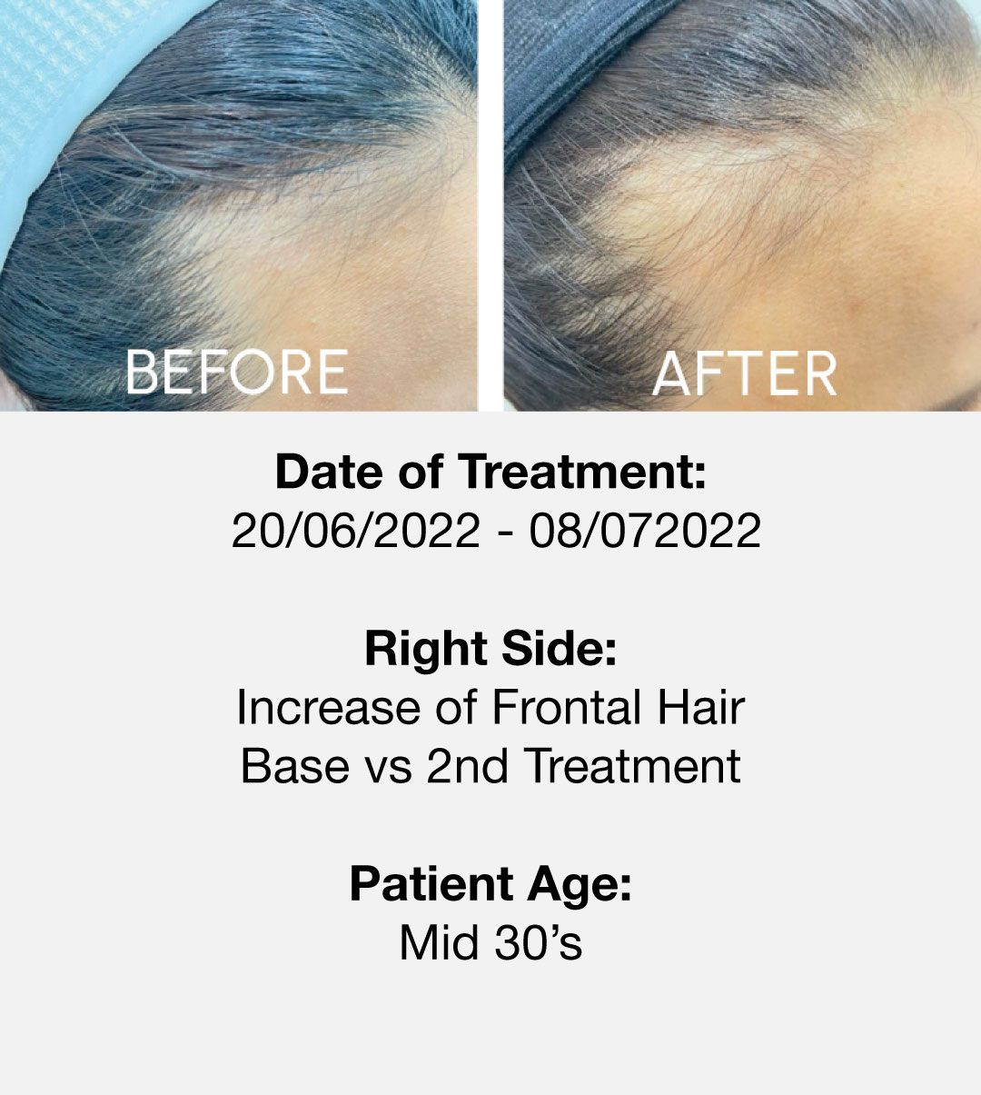 3pcell-testimonial3